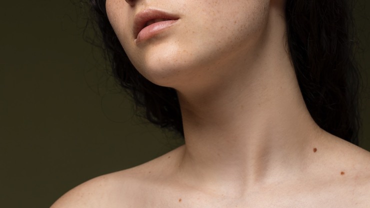 Por qué salen verrugas en el cuello y tratamientos